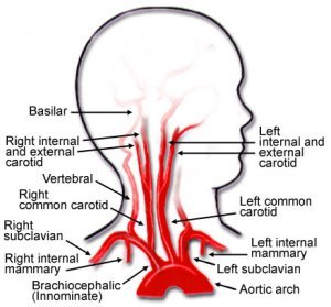 carotid_arteries.jpeg